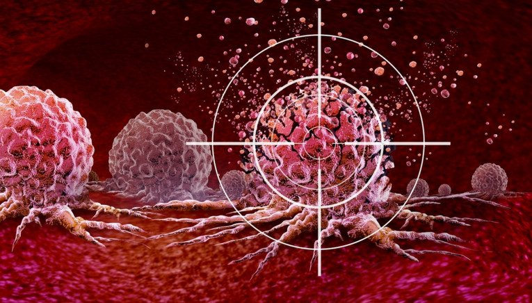 Ένας σπάνιος καρκίνος παρουσιάζει τεράστια αύξηση σε νέους ανθρώπους