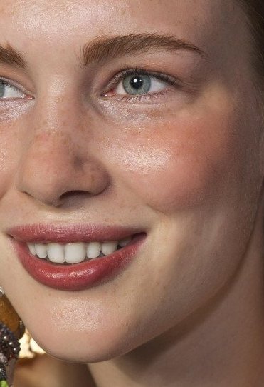 Η αιτία πίσω από το Αλτσχάιμερ ίσως κρύβεται στο στόμα μας!